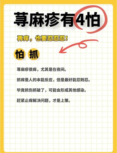 风湿性荨麻疹怎么治疗