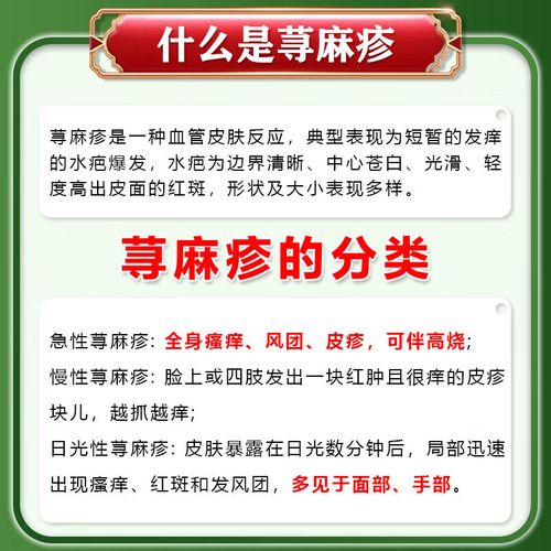 风湿性荨麻疹怎么治疗
