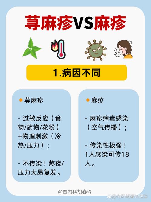 风湿性荨麻疹怎么治疗