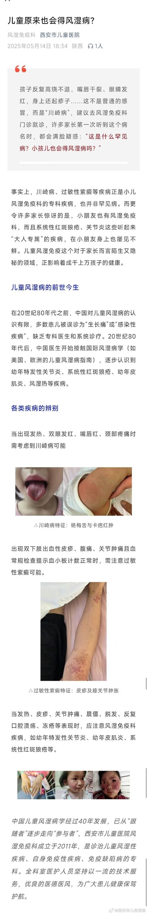 风湿热的病原体是什么