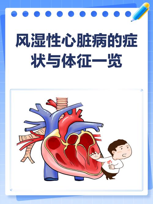 风湿性心脏病是否可治