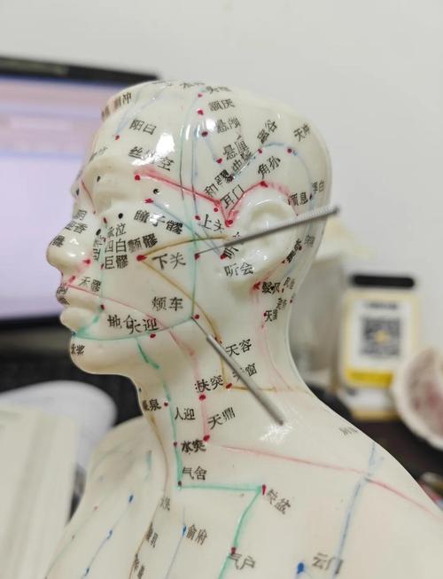 牙疼的中医穴位疗法