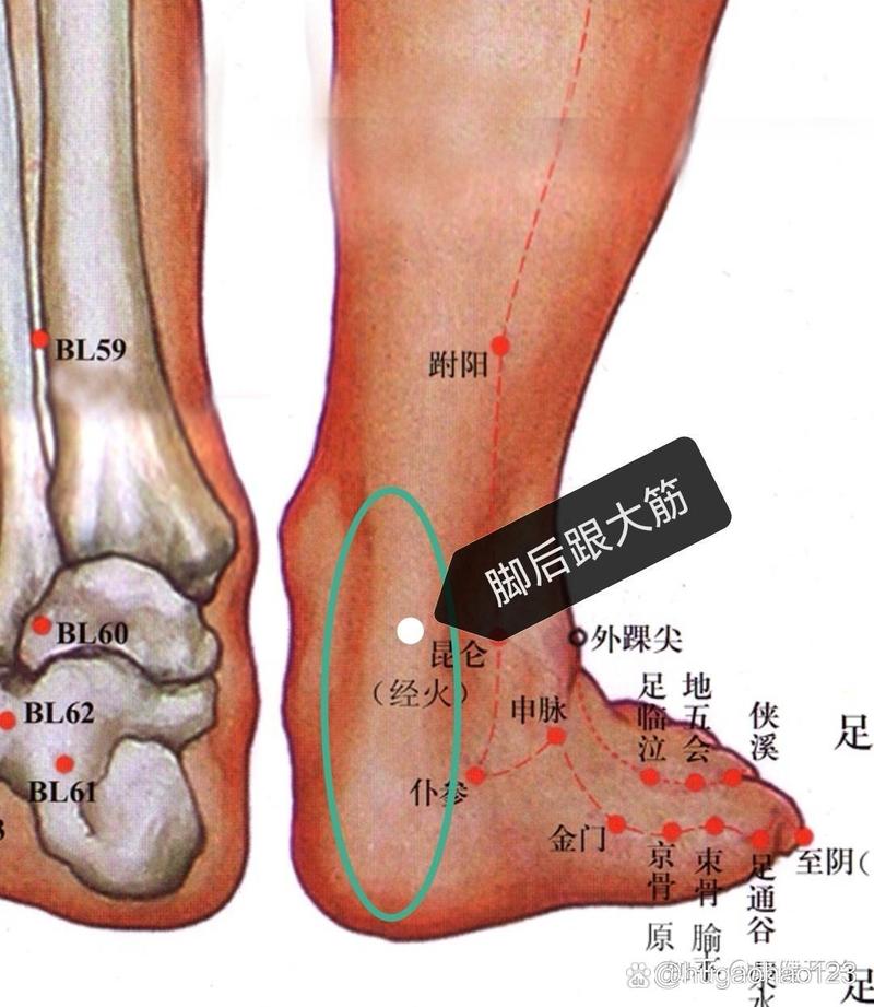 后脚跟疼 艾灸穴位