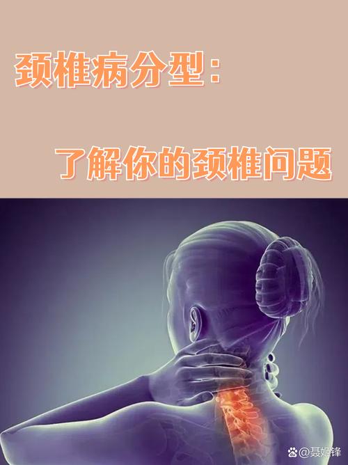 颈椎病还是风湿病区别