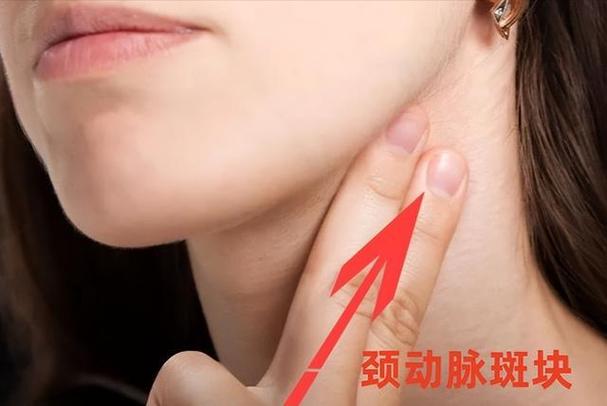 颈动脉斑块穴位按摩