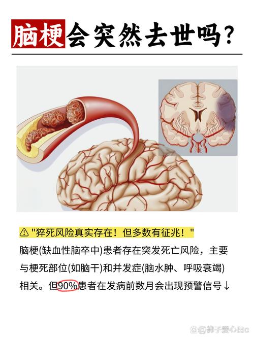 有脑梗倾向是有脑梗吗