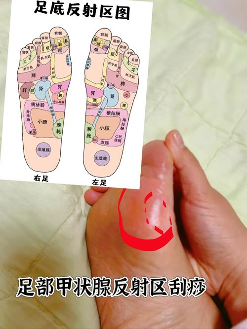 胃恶心按摩脚底穴位