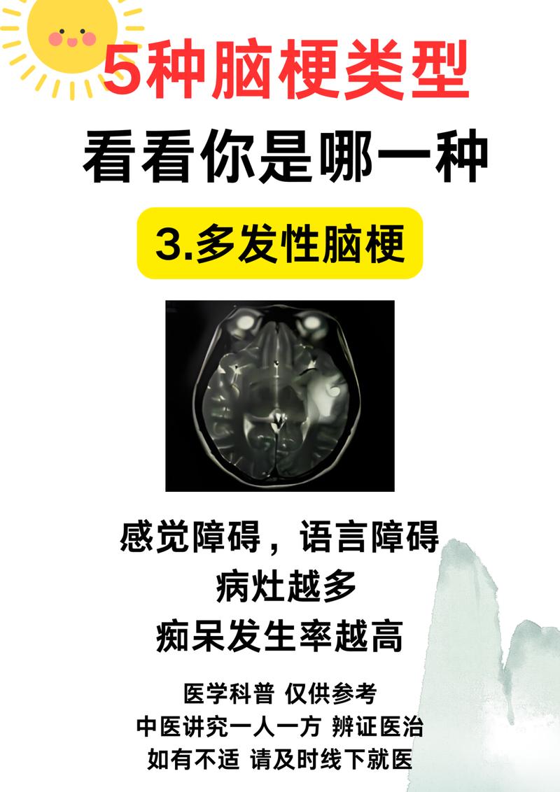 脑梗植物人还会脑梗吗