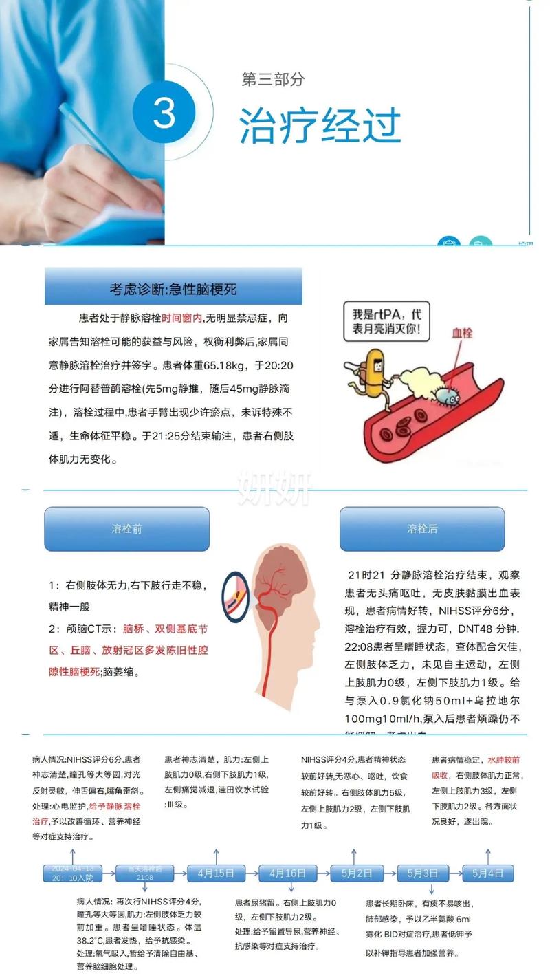 脑梗轻度脑梗能溶栓吗