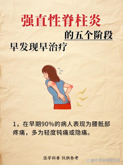 风湿性脊柱炎怎样治疗