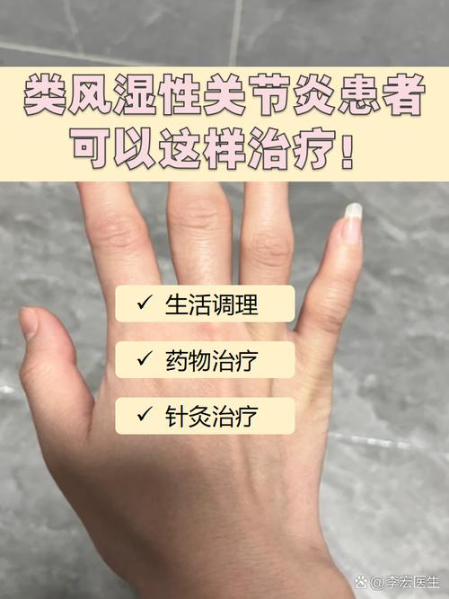 类风湿膝关节炎的治疗