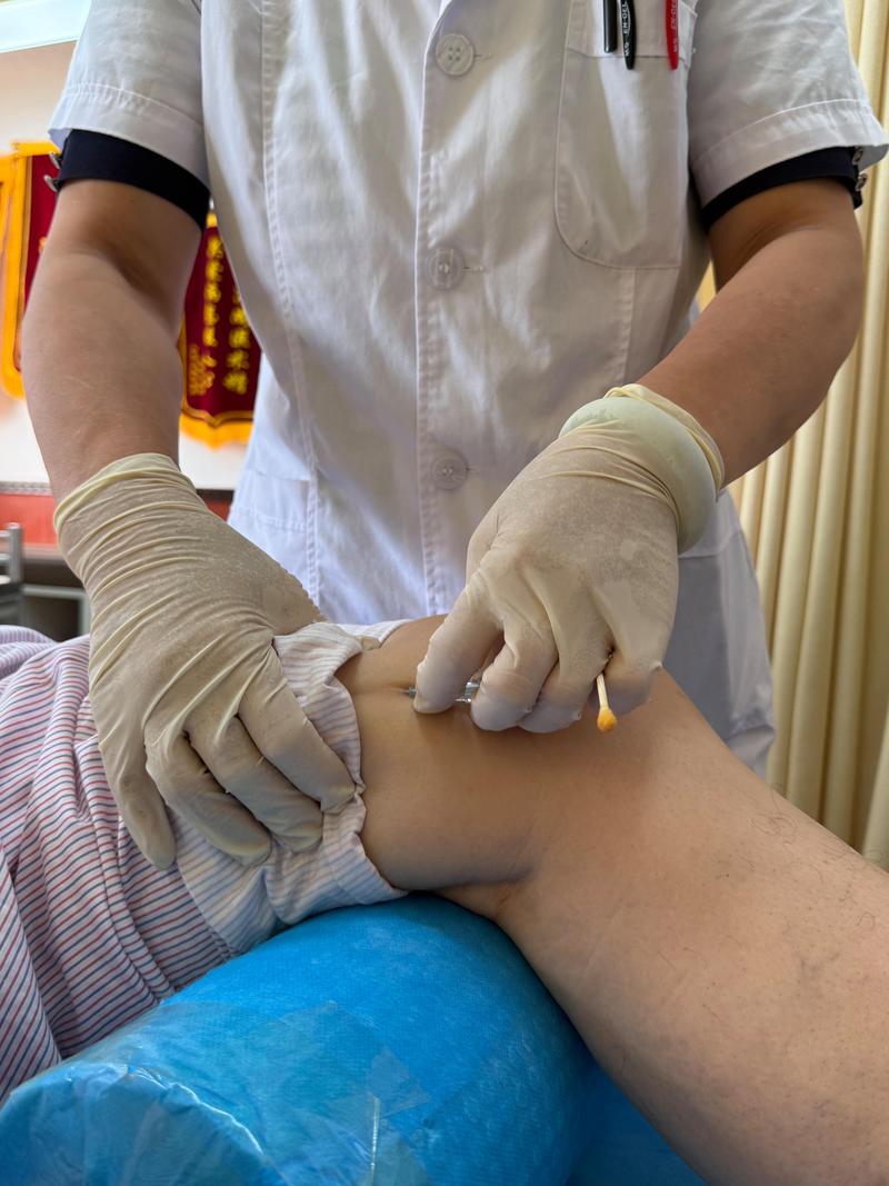 膝盖风湿性关节炎针灸