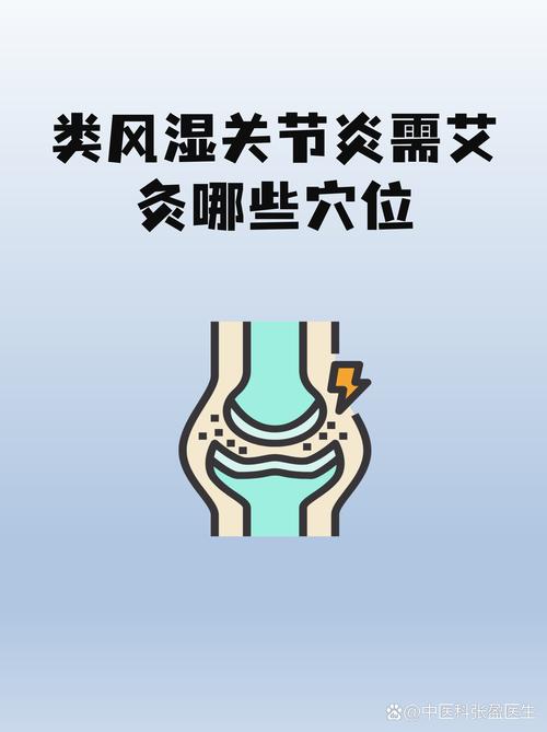 艾灸治类风湿关节炎吗