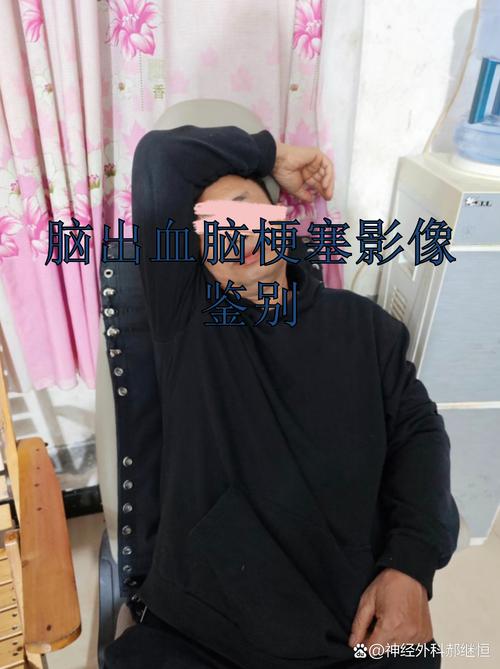 枕叶脑梗和脑梗的区别