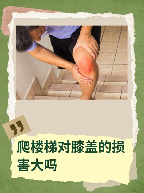 风湿关节炎能爬楼梯吗