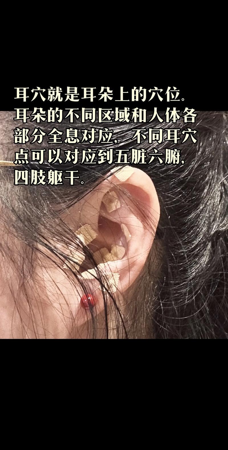 牙疼耳朵上面的穴位