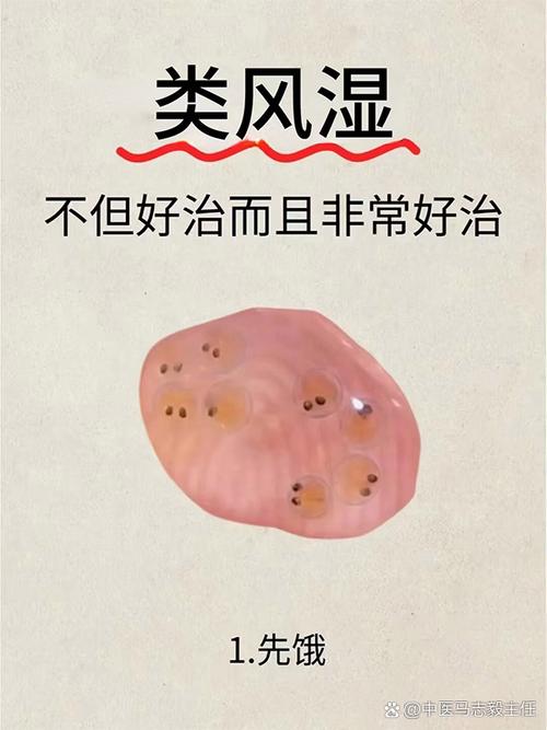 风湿病怎么治疗效果好