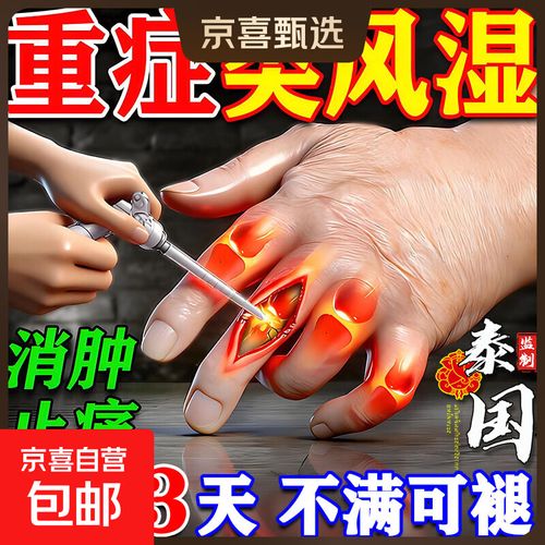 手指风湿性关节炎膏药