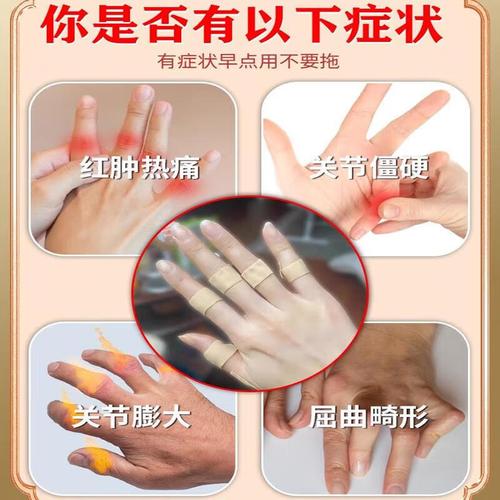 手指风湿性关节炎膏药