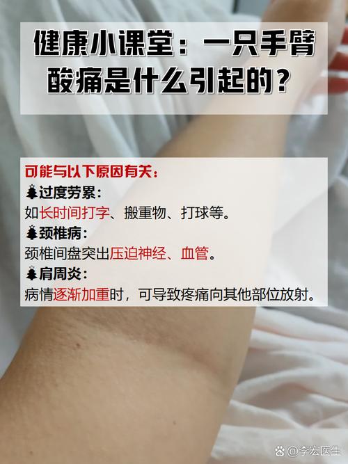 风湿性多肌痛会致残吗