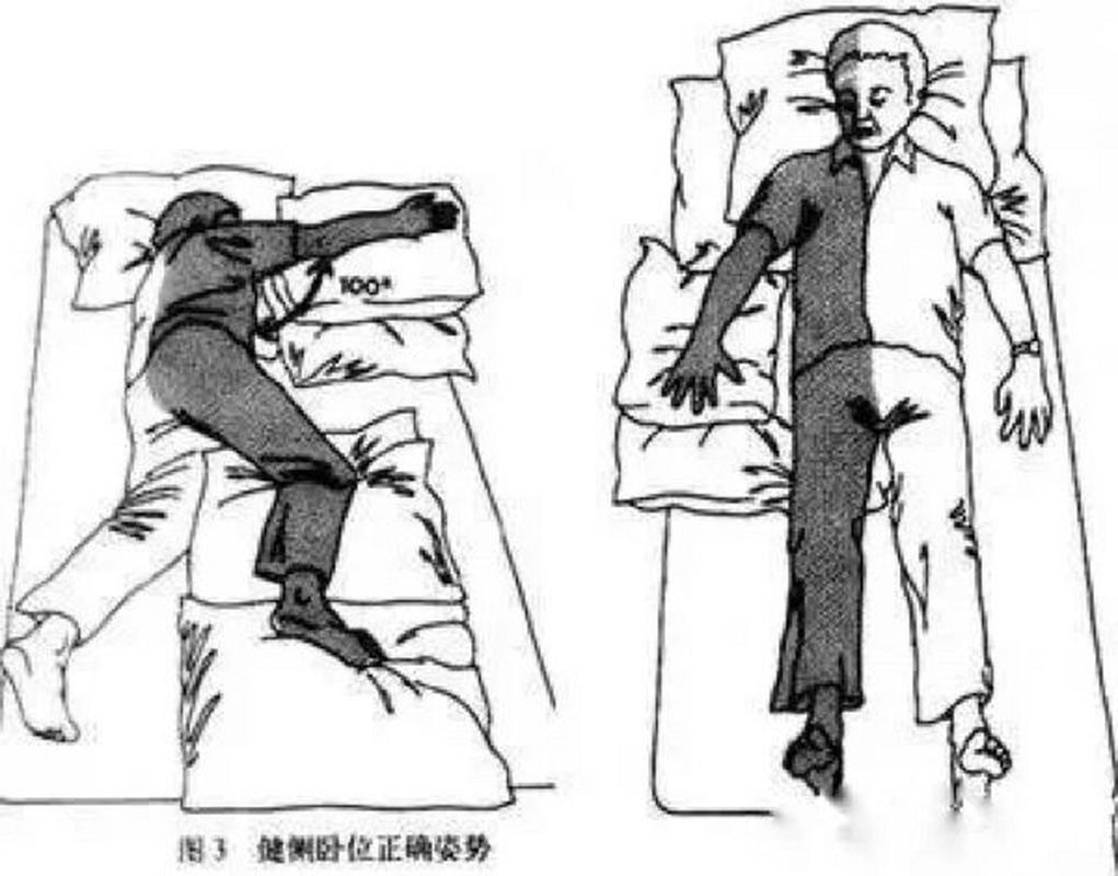 脑梗病人怎么能站起来