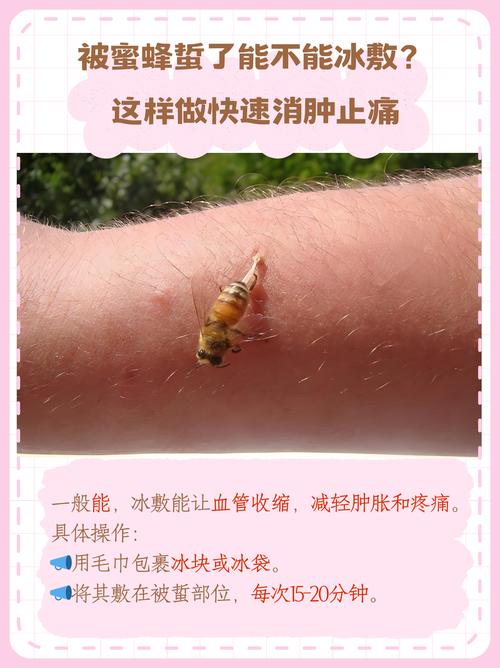 蜜蜂治疗风湿性关节炎