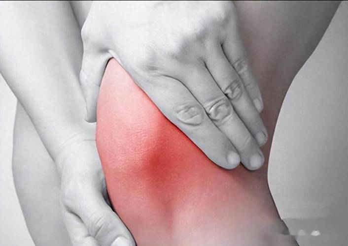 风湿性关节炎症状图片