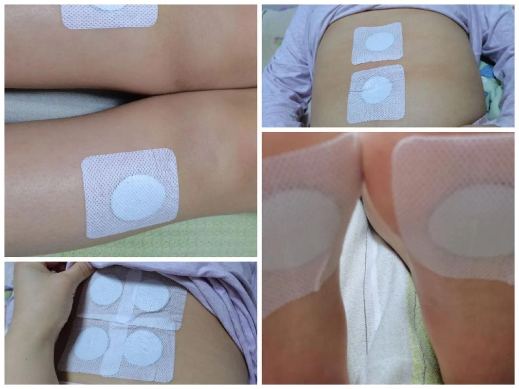 春季小儿生长穴位贴