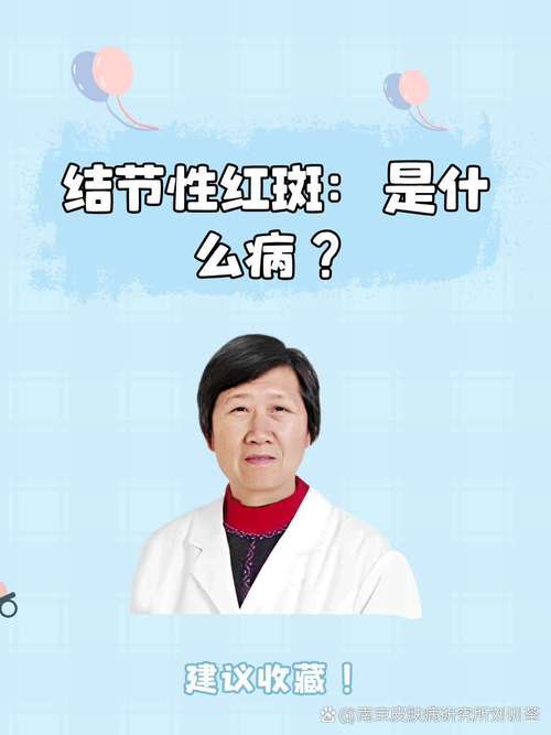 结节性红斑是风湿病吗