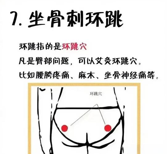 坐骨位置有什么穴位