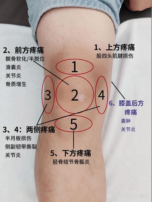 膝盖冷就疼是风湿病吗