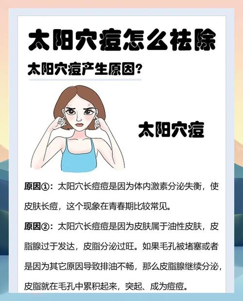 治疗青春痘 穴位