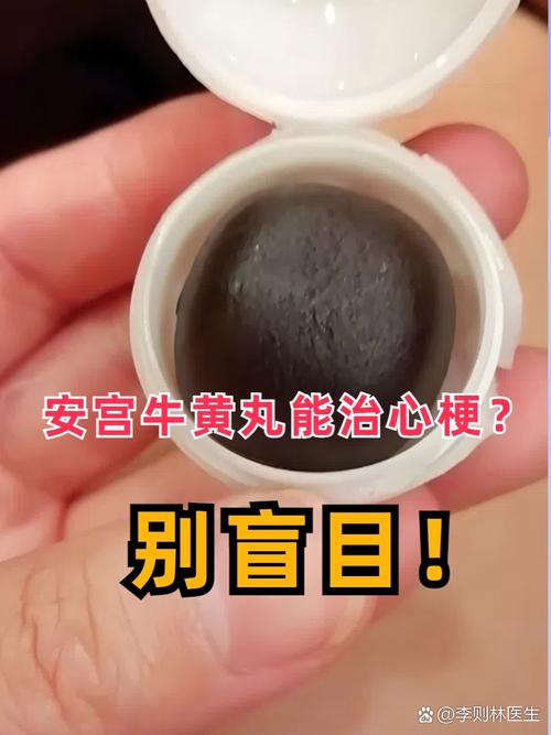 脑梗服用安宫牛黄丸吗