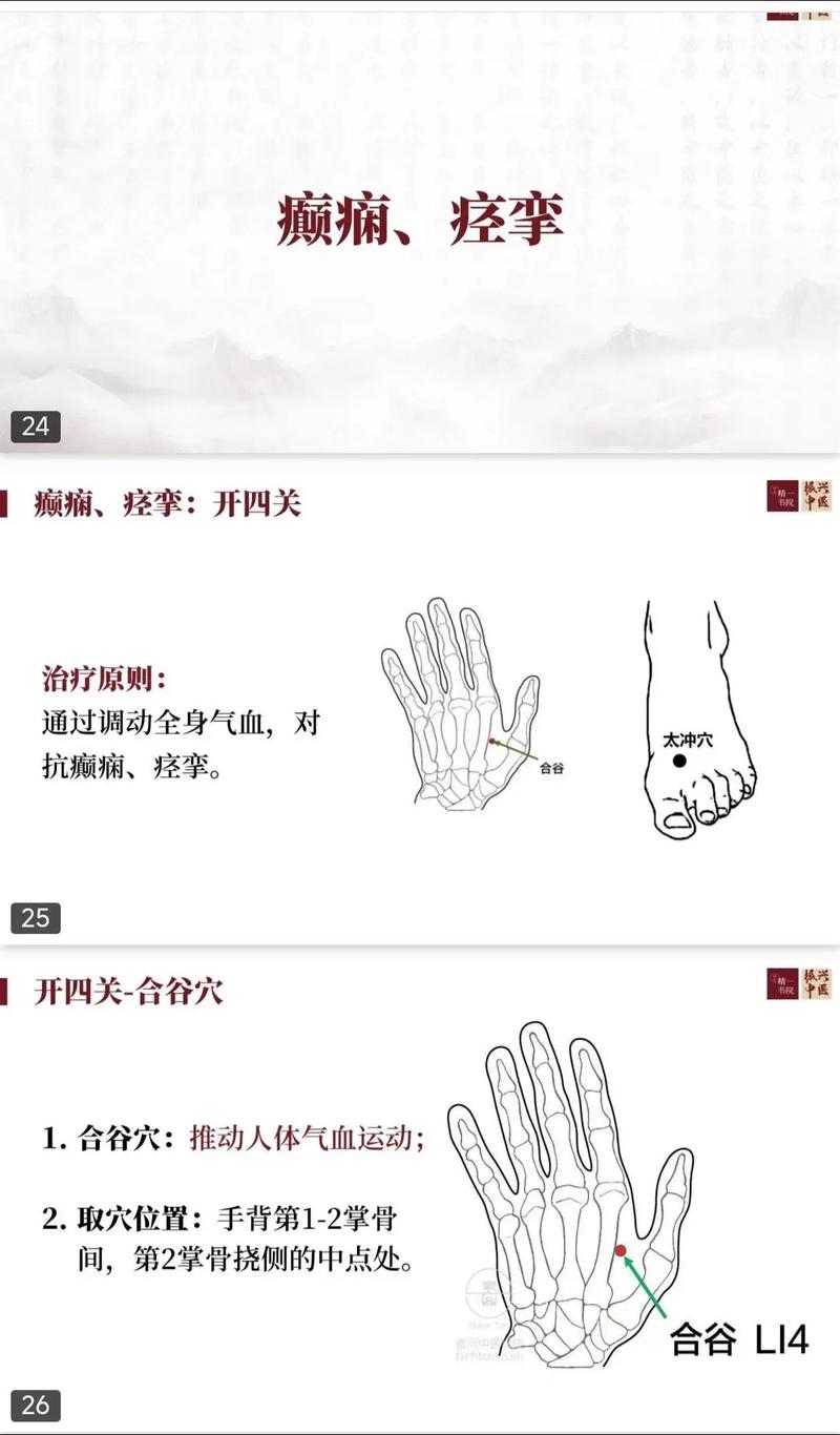 能够治疗癫痫的穴位