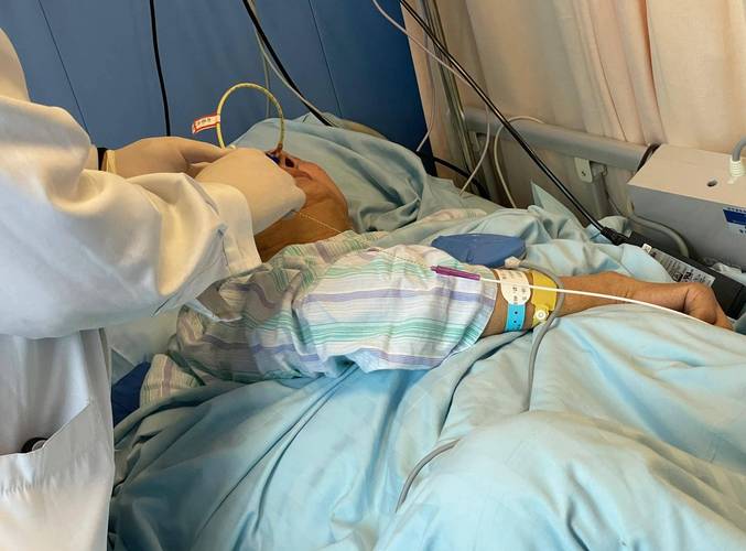 大面积脑梗手术成功率