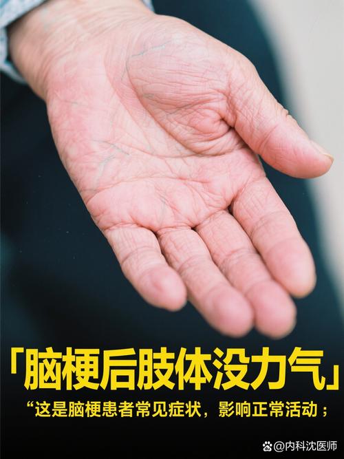 脑梗的人感觉四肢无力