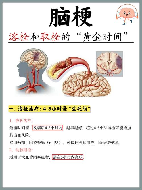 脑梗溶栓多长时间见效