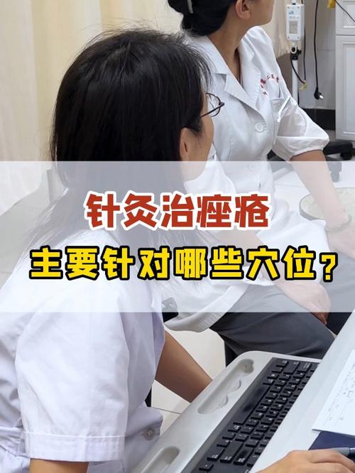 痤疮针灸穴位有哪些