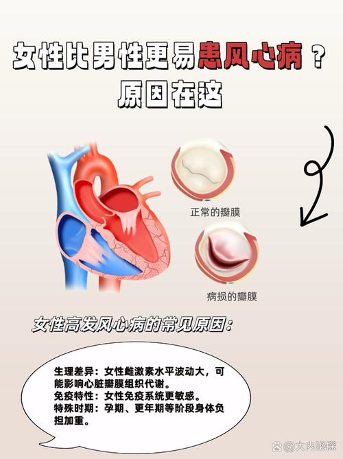 风湿性心脏瓣膜病体征