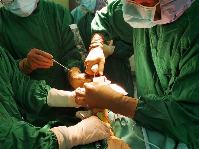 类风湿关节炎关节置换