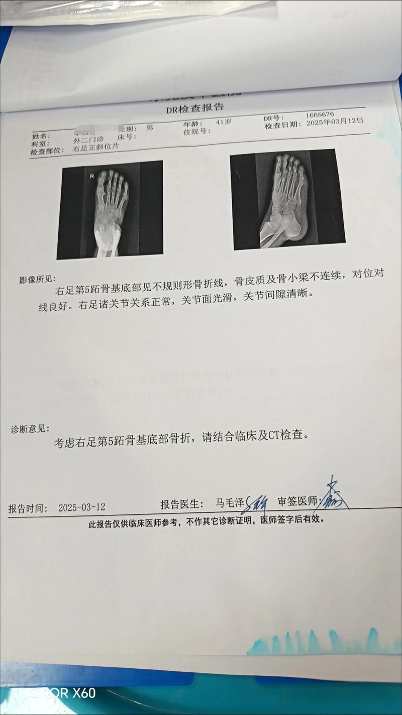 类风湿拍片能看出来吗