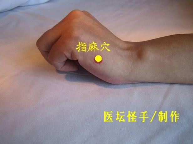 止血穴位 王文远