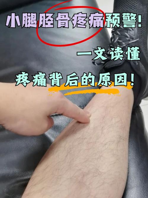 月子小腿肚疼是风湿吗