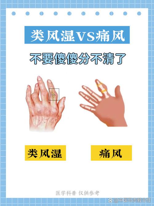 关节炎和风湿症状区别
