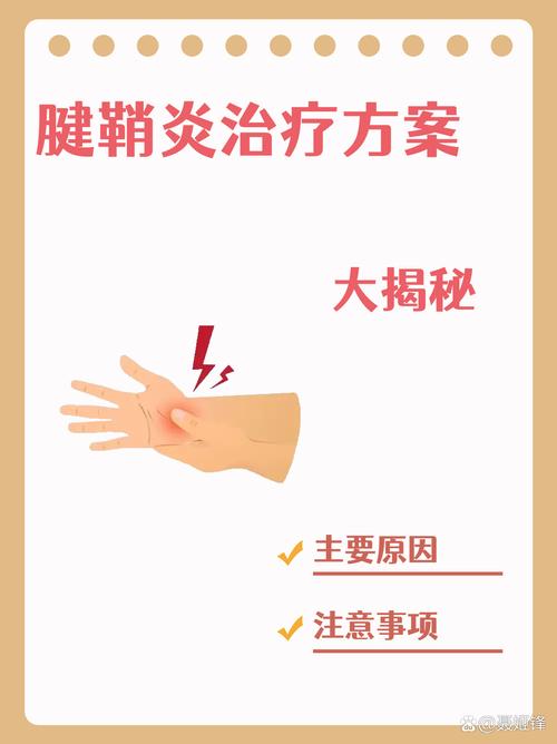 怎么治疗类风湿腱鞘炎