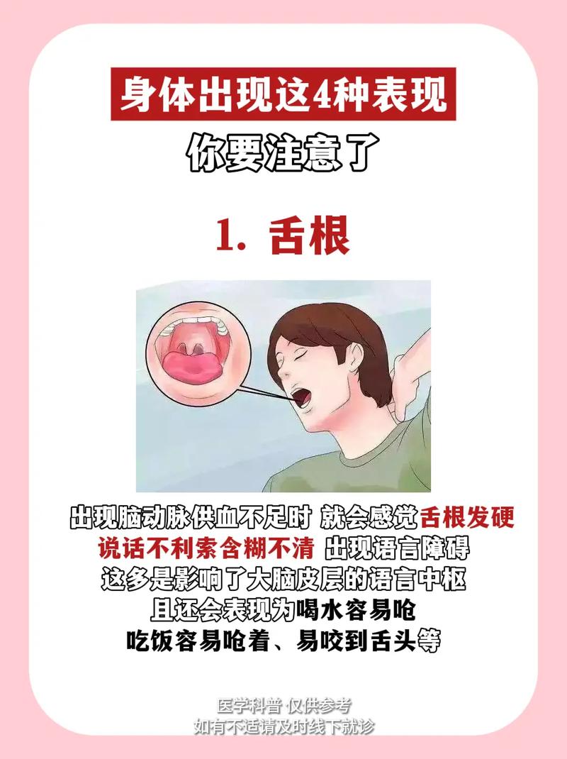 脑梗说不了话能治好吗