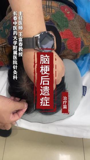 脑梗患者有什么后遗症