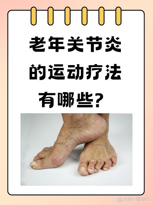 类风湿关节炎运动注意