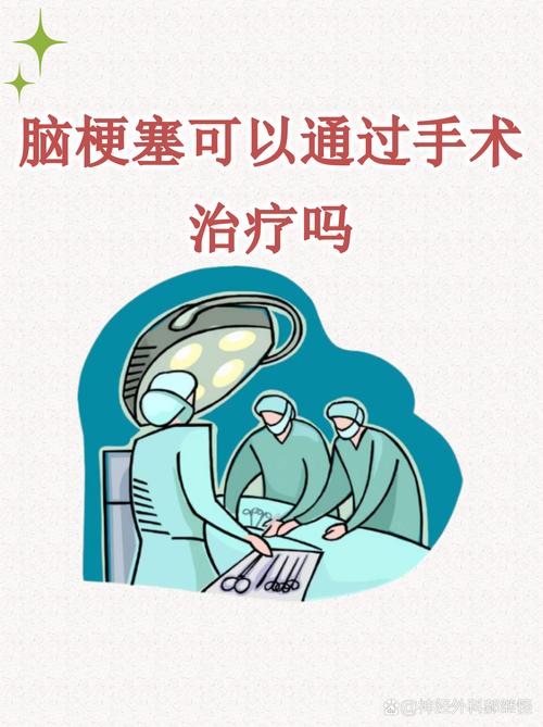 脑梗支架手术用开卢吗