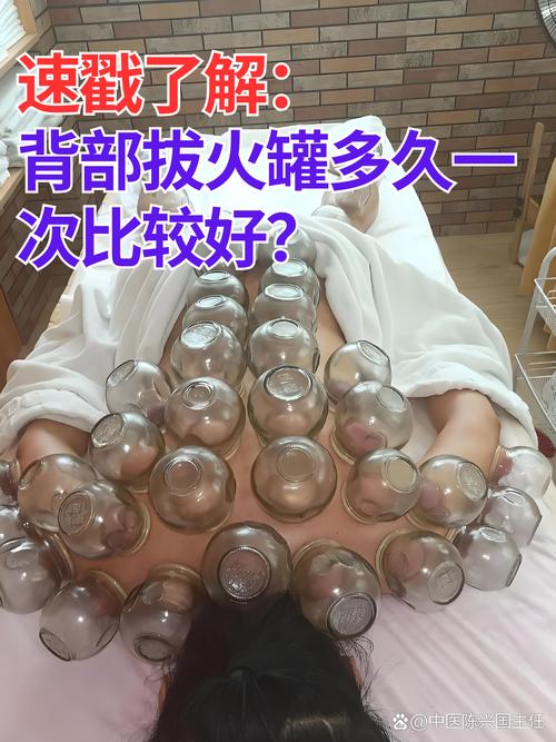 拔火罐后能贴风湿膏吗